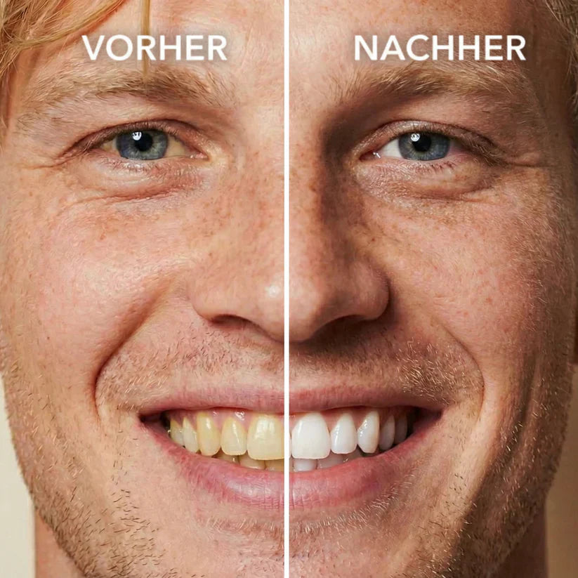 🦷 Zahnweiß-Politur zum Auftragen – Sichtbar weißere Zähne & Entfernt Verfärbungen, Enamelschonend & Fluoridfrei, Für empfindliche Zähne