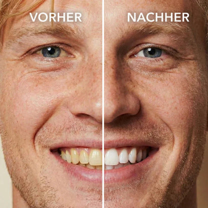 🦷 Zahnweiß-Politur zum Auftragen – Sichtbar weißere Zähne & Entfernt Verfärbungen, Enamelschonend & Fluoridfrei, Für empfindliche Zähne
