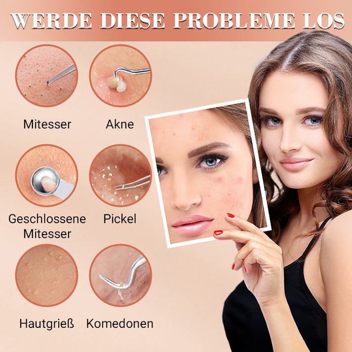 🆙✨ Profi Poren-Reinigungs-Set (7-tlg) – Für makellose, reine Haut