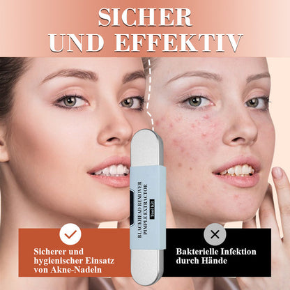🆙✨ Profi Poren-Reinigungs-Set (7-tlg) – Für makellose, reine Haut