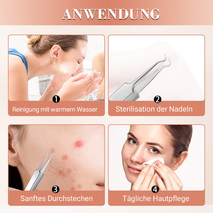 🆙✨ Profi Poren-Reinigungs-Set (7-tlg) – Für makellose, reine Haut