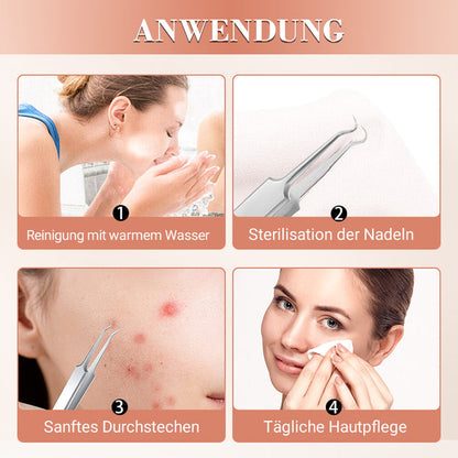 🆙✨ Profi Poren-Reinigungs-Set (7-tlg) – Für makellose, reine Haut